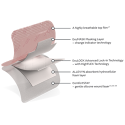 Allevyn Complete Care 1